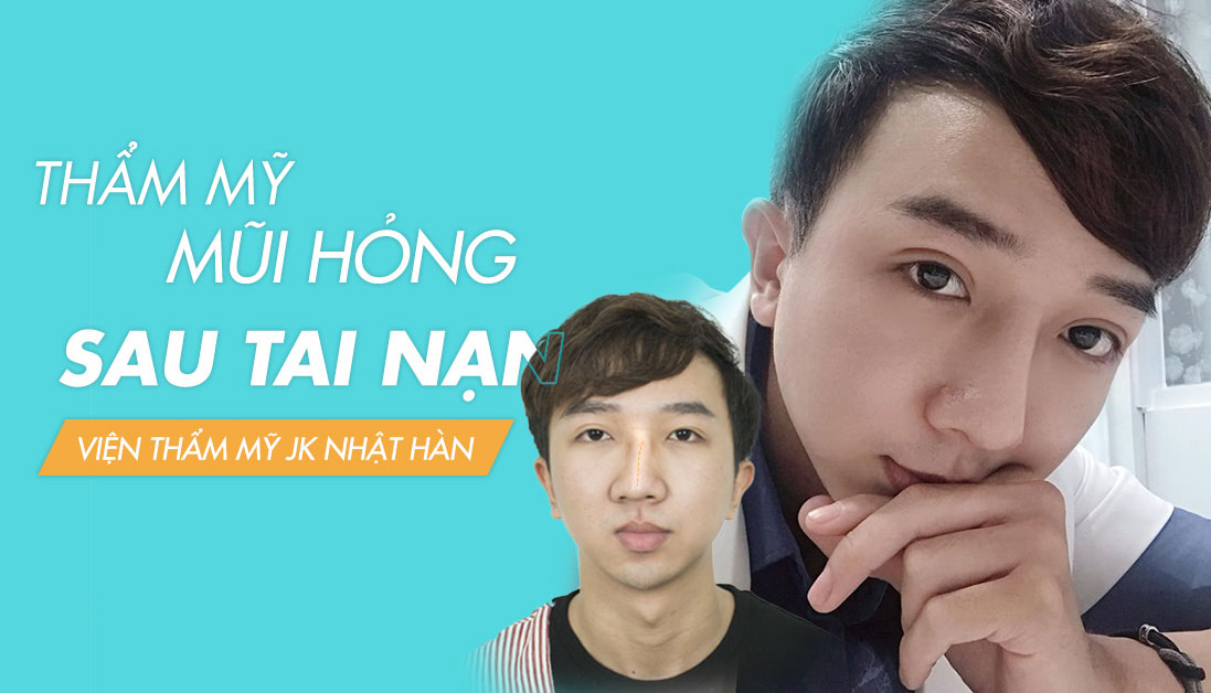 Video tư vấn thẩm mỹ