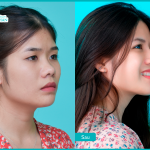 Ý nghĩa của nghề thẩm mỹ điều bạn không thể bỏ qua