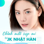 Phẫu Thuật Chữa Sụp Mí Mắt - Trị 1 Lần Đẹp Vĩnh Viễn