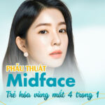 PHẪU THUẬT MIDFACE - TRẺ HÓA VÙNG MẮT 4 TRONG 1