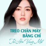 TREO CHÂN MÀY BẰNG CHỈ - TRẺ HÓA VÙNG MẮT