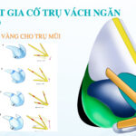 Đôi nét về nâng mũi J-line điều bạn nên biết