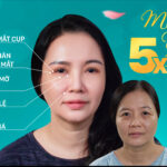 Mini Eyes 5X - Trẻ hoá mắt toàn diện
