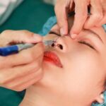 Những dấu hiệu nhiễm trùng sau khi nâng mũi và cách xử lý