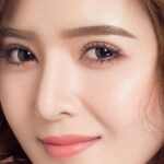 Nhấn mí khoảng bao lâu thì lành? Có sưng không ? Có đau không? 
