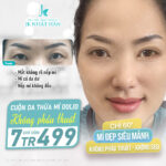 Cuộn da thừa mí Dolid - Thẩm mỹ mắt không phẫu thuật hiệu quả cực cao