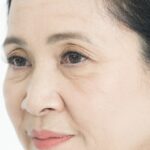 Xem tướng mắt nhiều mí hé lộ vận mệnh tướng số
