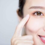 Hình ảnh cắt mí mắt sau 1 tháng thực tế trông như thế nào?