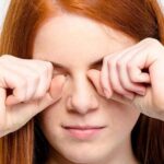 Cách giảm sưng sau khi cắt mí mắt hiệu quả tại nhà