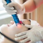 Bật mí những cách trị thâm mắt lâu năm hiệu quả