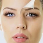 Nguyên nhân và cách khắc phục nếp nhăn dưới bọng mắt