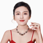 Thẩm mỹ lấy mỡ mắt bao lâu thì lành?