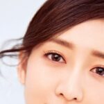 Phẫu thuật mở rộng góc mắt có làm sưng mặt hay không?