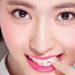 Bao lâu thì lành khi mở rộng góc mắt?