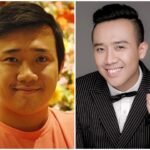 Nghi án Trấn Thành sửa mũi có thật hay không?