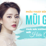Phẫu thuật sửa mũi gồ phải mài xương mũi mới hiệu quả