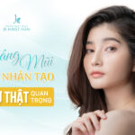 3 Sự thật quan trọng về nâng mũi sụn nhân tạo
