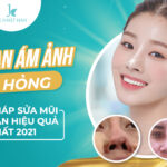 Sửa lại mũi đã phẫu thuật - Chuyên gia giải cứu mũi hỏng 20 năm kinh nghiệm
