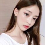 Nâng mũi sụn surgiform giá bao nhiêu? 
