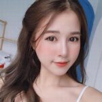 Những hiện tượng sau khi cắt mí mắt có thể xảy ra mà bạn nên biết?