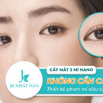 THẨM MỸ CẮT MÍ MẮT BAO NHIÊU TIỀN? CẮT MÍ NANO KHÔNG CẦN CẮT CHỈ