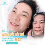 Cắt mí đổi ánh nhìn -  Tạo hình mắt đẹp rạng ngời thêm xinh