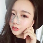 Có nên sử dụng dụng cụ định hình nâng mũi hay không?