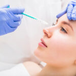 Nâng mũi không phẫu thuật bằng Restylane Perlane