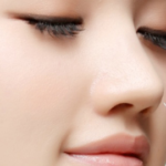 Nâng mũi radies giữ được bao lâu?