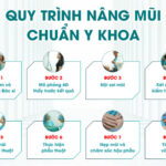 Các bước phẫu thuật nâng mũi chuẩn y khoa - Nhất định phải biết