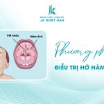 Hở hàm ếch: Nguyên nhân, cách điều trị và biện pháp phòng ngừa