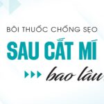 Bôi thuốc chống sẹo sau cắt mí bao lâu?