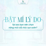 Bật mí lý do tại sao bạn nên chọn nâng mũi cấu trúc sụn sườn?