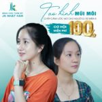 Chi phí phẫu thuật sứt môi hở hàm ếch tại bệnh viện chuyên sâu