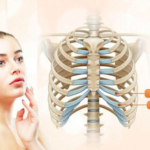 Nâng mũi sụn sườn có bị teo lại không?