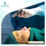 Nguyên nhân bị bầm tím sau khi nâng mũi và cách cải thiện