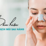 Dấu hiệu bị tụ dịch sau nâng mũi - Giải pháp thẩm mỹ an toàn