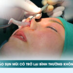 Tháo sụn mũi có trở lại bình thường không? Chuyên gia giải đáp