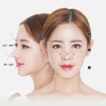 Biểu hiện của dị ứng chất liệu nâng mũi và hướng khắc phục