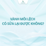 Vành môi lệch có sửa lại được không?
