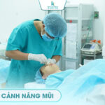 Cận cảnh nâng mũi 10+ video và hình ảnh
