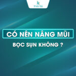 Có nên nâng mũi bọc sụn không - Lời khuyên từ chuyên gia