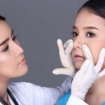 Da mũi ít có nâng mũi được không - Chuyên gia giải đáp