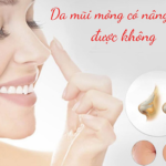 Da mũi mỏng có nâng mũi được không? 3 lưu ý quan trọng nên biết