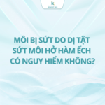 Môi bị sứt do dị tật sứt môi hở hàm ếch có nguy hiểm không?