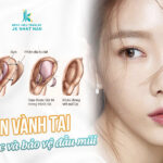 10+ Hình ảnh và video cận cảnh nâng mũi bọc sụn