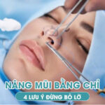 Có nên nâng mũi bằng chỉ không - 4 lưu ý đừng bỏ lỡ